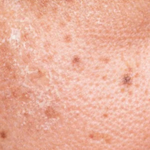 Darkspots