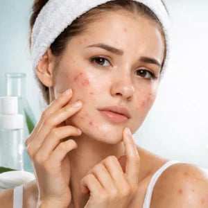 Anti Prone Skin